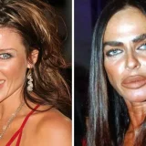 整形失敗がささやかれる芸能人&海外セレブTOP40