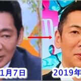 【知らなかった】整形を公表している20人の芸能人