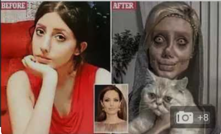 【異次元】整形で大失敗した世界の事例まとめ25選